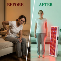Red Light Therapy Full Body Panel, 480/630/660/810/830/850/1060Nm Blue Red near Infrared Light Device with 480 Dual Chip Clinical Grade Leds, Remote Control, Timer for Face, Body, BO-2400 — Before & After